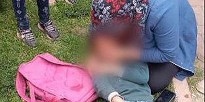 Kayseri’de Otomobilin Çocuğa Çarptığı Çocuk Yaralandı