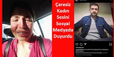 Boşandığı Eşinden Şiddet Gören Sibel, Sosyal Medyadan Yardım İstedi