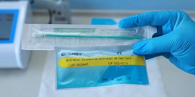 Covid-19 PCR Test Sonucu Çıkana Kadar Hangi Önlemleri Almalıyız?