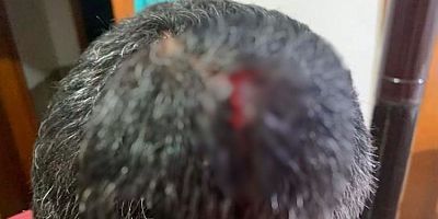 Darp Fotoğraflarını Paylaşan Muhtar, Belediye Başkanını Sorumlu Tuttu