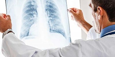 Kayseri’de Covid-19 Sonrası Zatürreli Sayısı Artıyor!