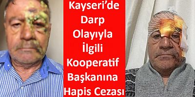 Kayseri’de Darp Olayıyla İlgili Kooperatif Başkanına Hapis Cezası