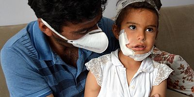 Kayseri'de Kurt Saldırısında Yaralanan Eylül Taburcu Edildi