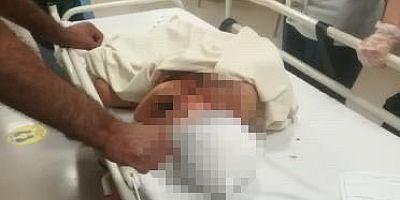 Kayseri'de yırtıcı hayvanın saldırdığı çocuk yaralandı