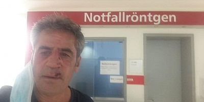 Kayserili Gazeteci Almanya’da Evinin Önünde Darp Edildi