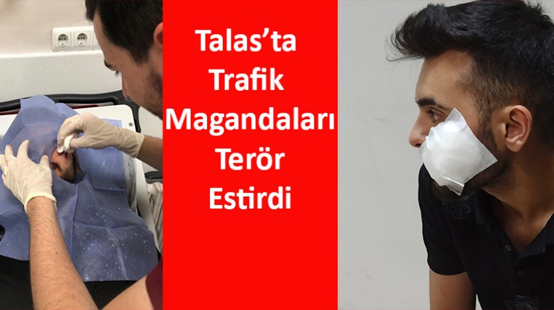 Talas’ta Trafik Magandaları Terör Estirdi